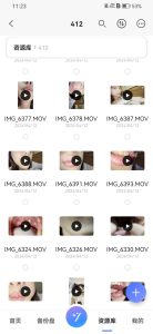 合作代售口腔作品-412最新口腔拍摄-派大星